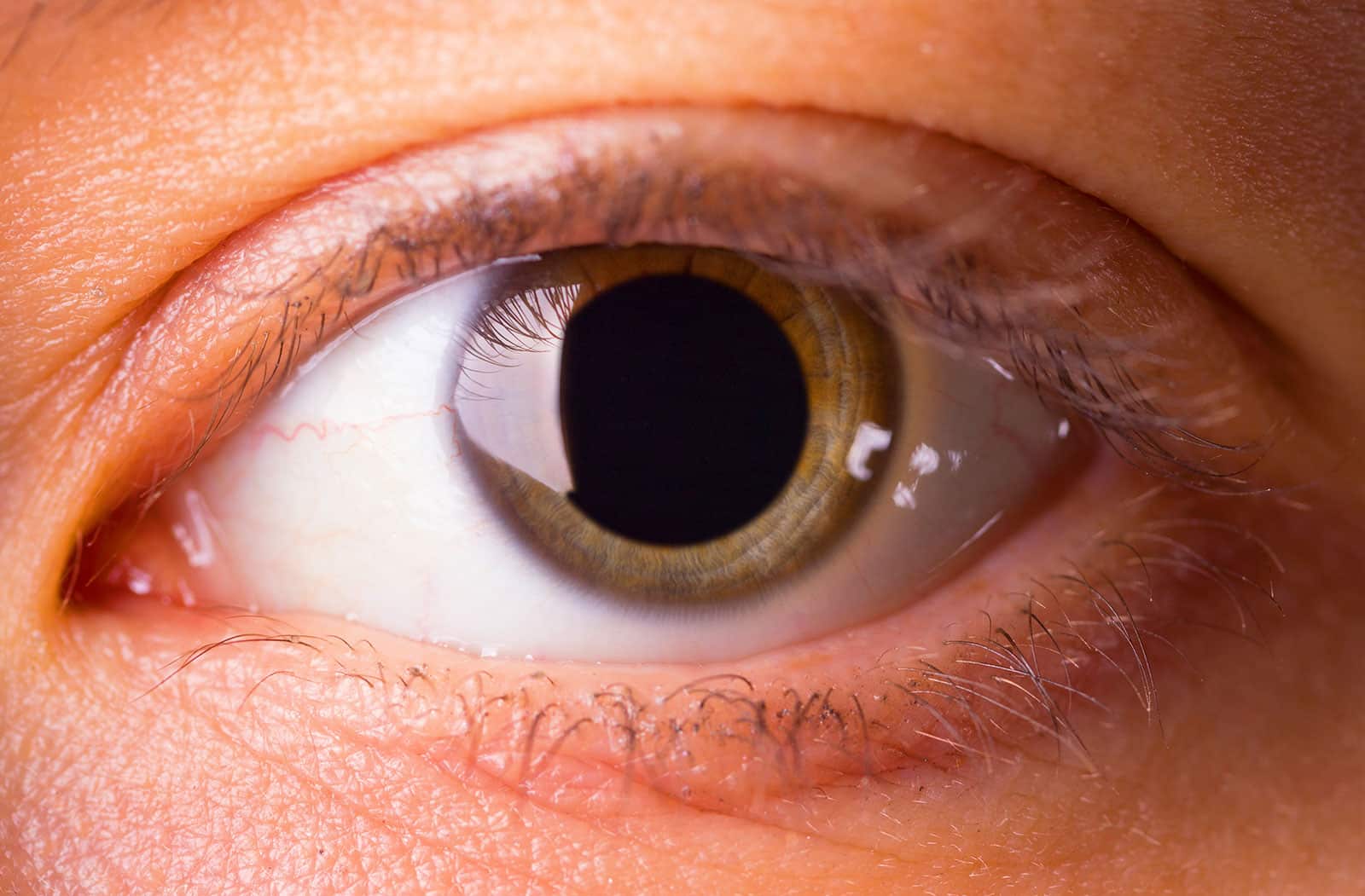 What Prescribed and Nonprescribed Drugs Cause Dilated Pupils?