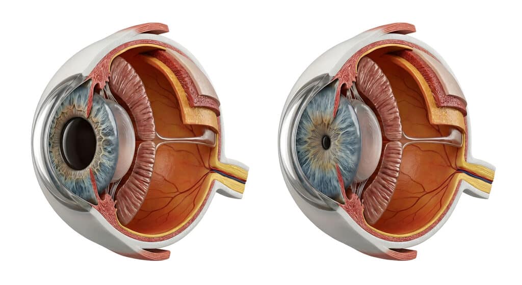 Pinpoint Pupils